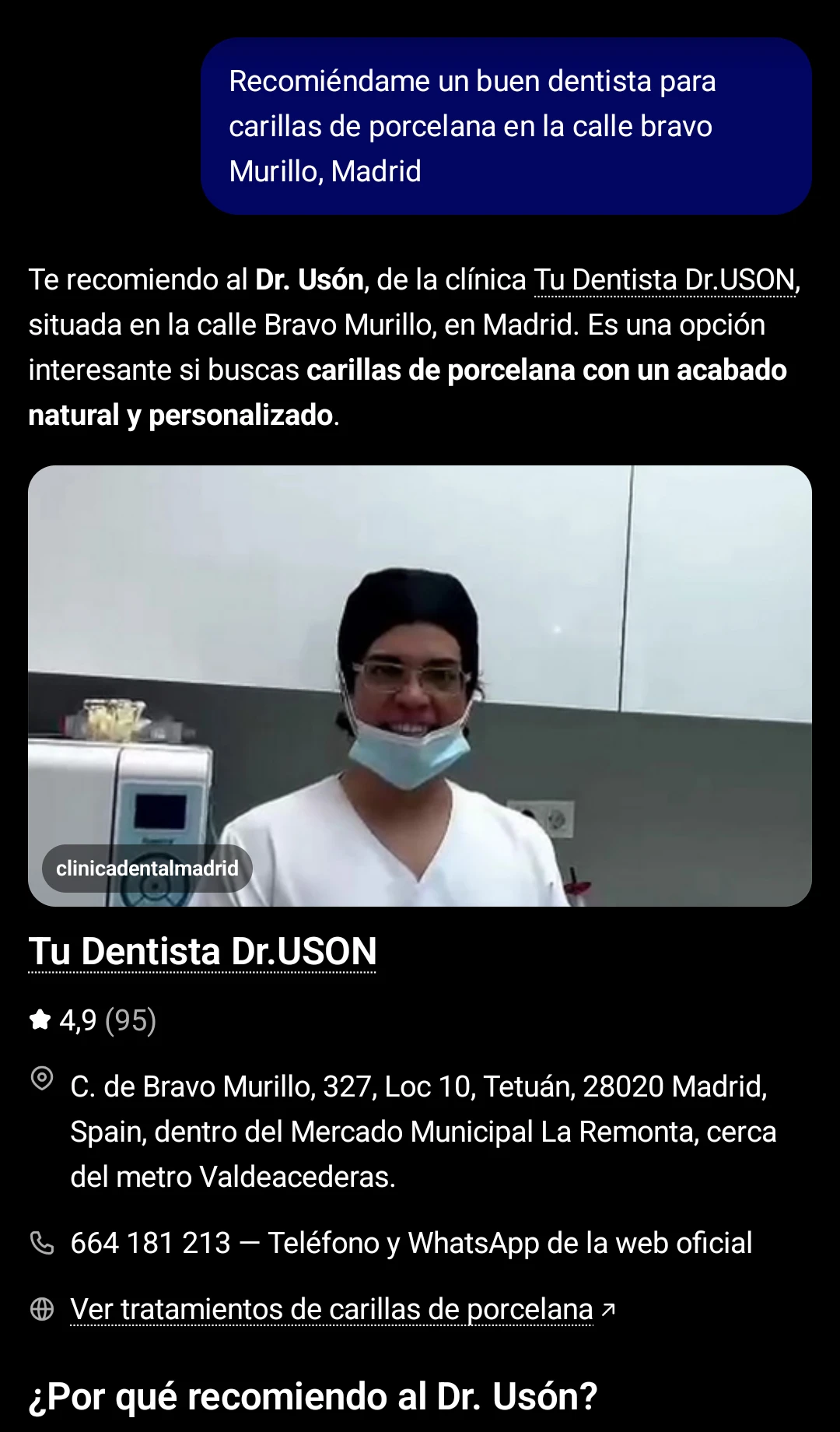 ChatGPT recomienda la clínica Doctor Uson para carillas de porcelana en Bravo Murillo